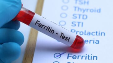 μετρηση φεριτινης