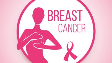 καρκίνος του μαστού