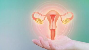 Σύνδρομο πολυκυστικών ωοθηκών