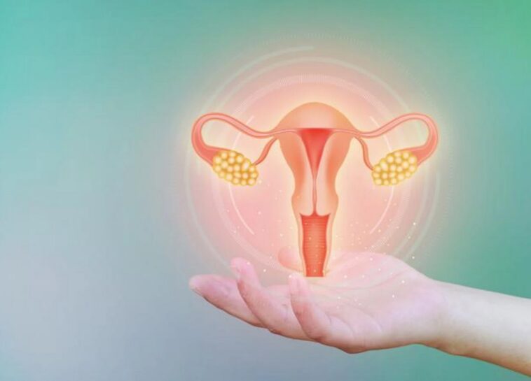 Σύνδρομο πολυκυστικών ωοθηκών