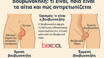 βουβονοκήλη