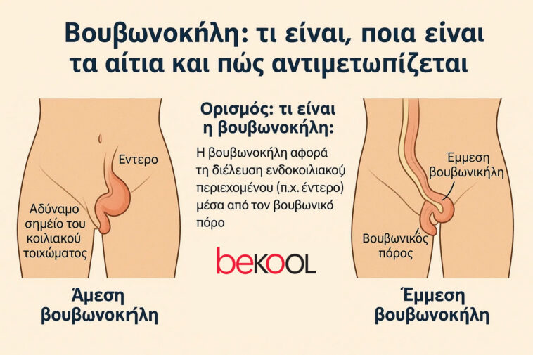 βουβονοκήλη