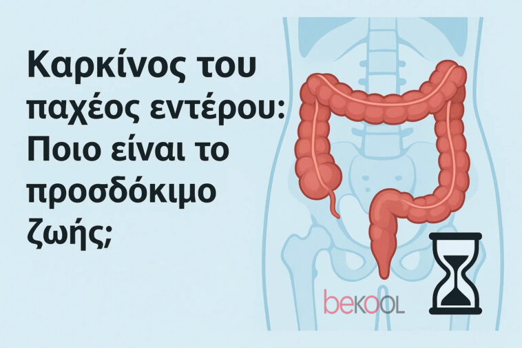 καρκινος παχεως εντερου προσδόκιμο ζωης