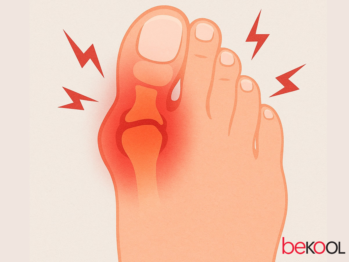 Ουρική αρθρίτιδα: Διατροφή και θεραπείες για το υψηλό ουρικό οξύ