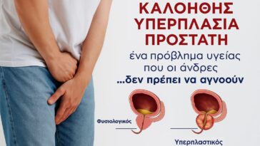 Καλοήθης υπερπλασία προστάτη