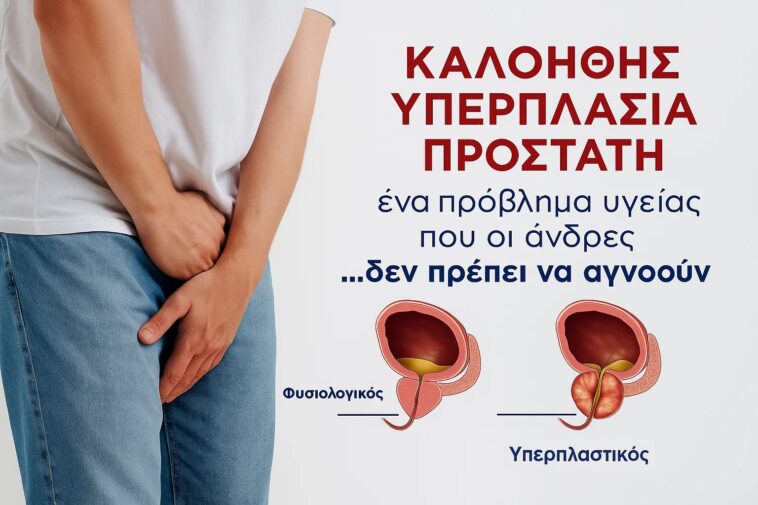 Καλοήθης υπερπλασία προστάτη