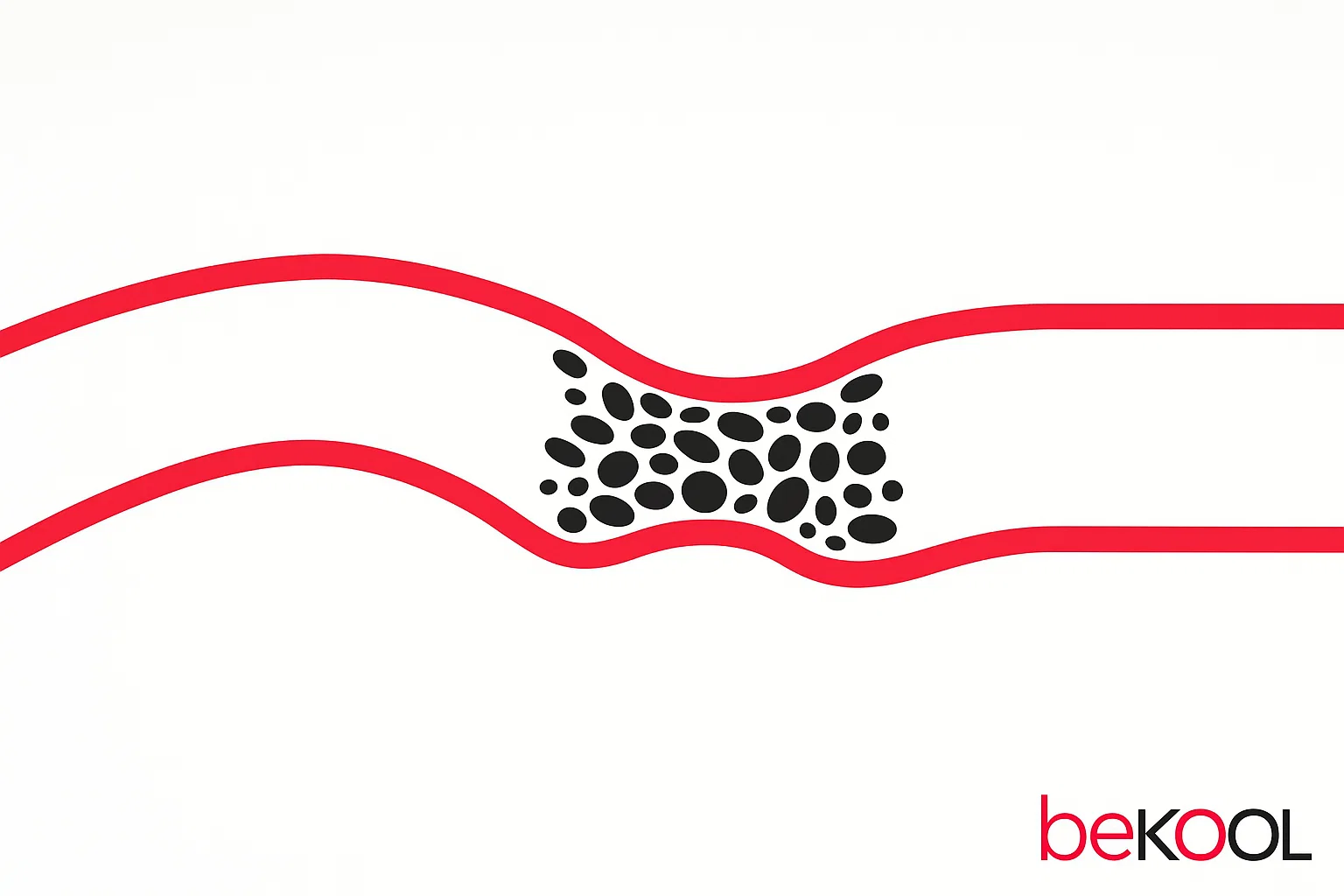 triplex αγγείων