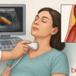 triplex αγγείων