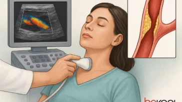 triplex αγγείων