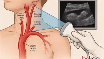 triplex καρωτίδων