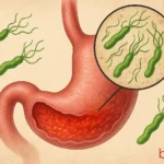 Ελικοβακτηρίδιο του πυλωρού