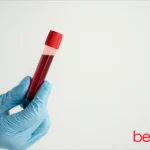 Εξέταση αίματος