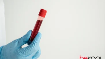 Εξέταση αίματος