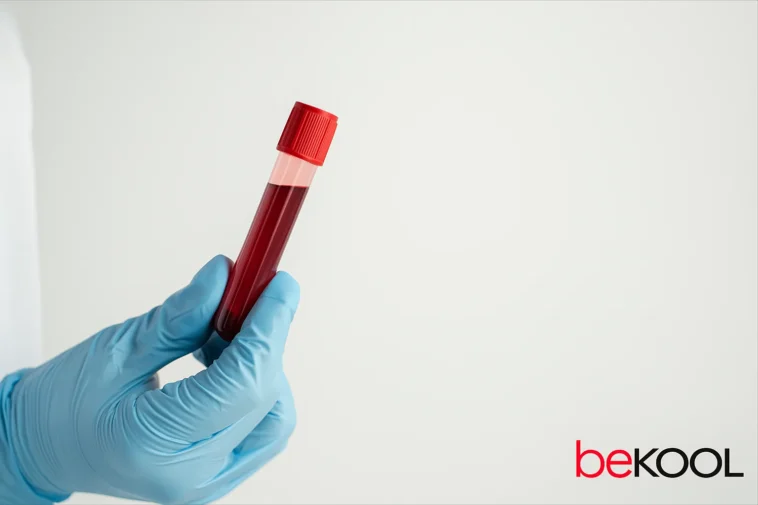 Εξέταση αίματος