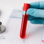 Πόσο συχνά πρέπει να κάνεις αιματολογικές εξετάσεις