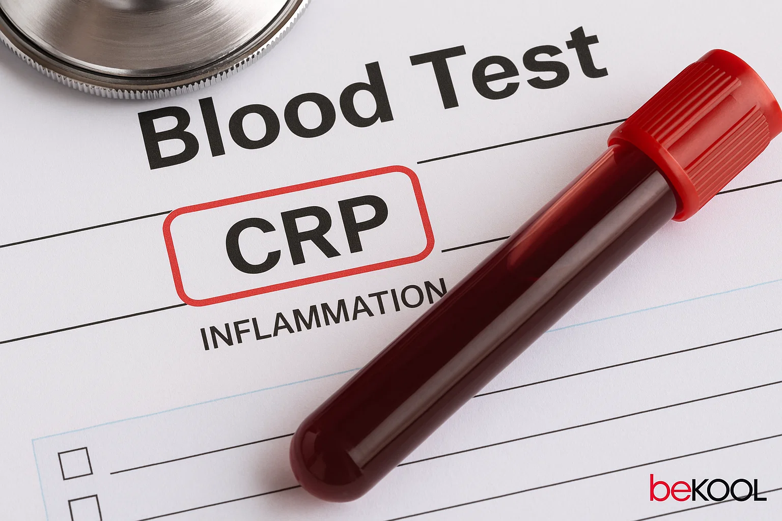 Τι δείχνει  η CRP