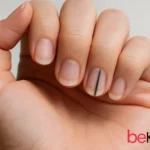 Το σημάδι στα νύχια που δείχνει ότι πρέπει να πας για check-up