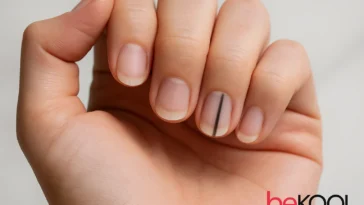 Το σημάδι στα νύχια που δείχνει ότι πρέπει να πας για check-up