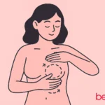 αυτοεξεταση μαστου