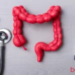 Προληπτική κολονοσκόπηση