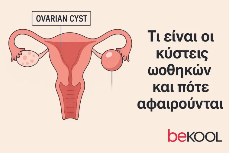 Κύστεις ωοθηκών