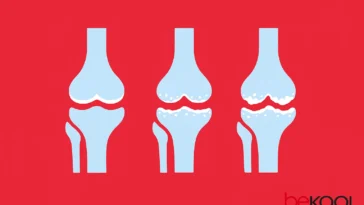 Οστεοαρθρίτιδα