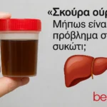 Σκούρα ούρα