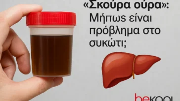 Σκούρα ούρα