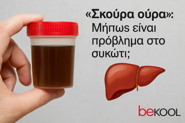 Σκούρα ούρα