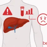 Αυξημένα ηπατικά ένζυμα
