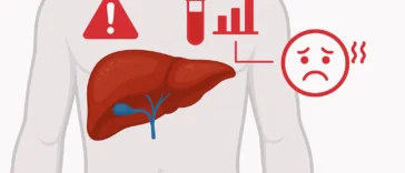 Αυξημένα ηπατικά ένζυμα