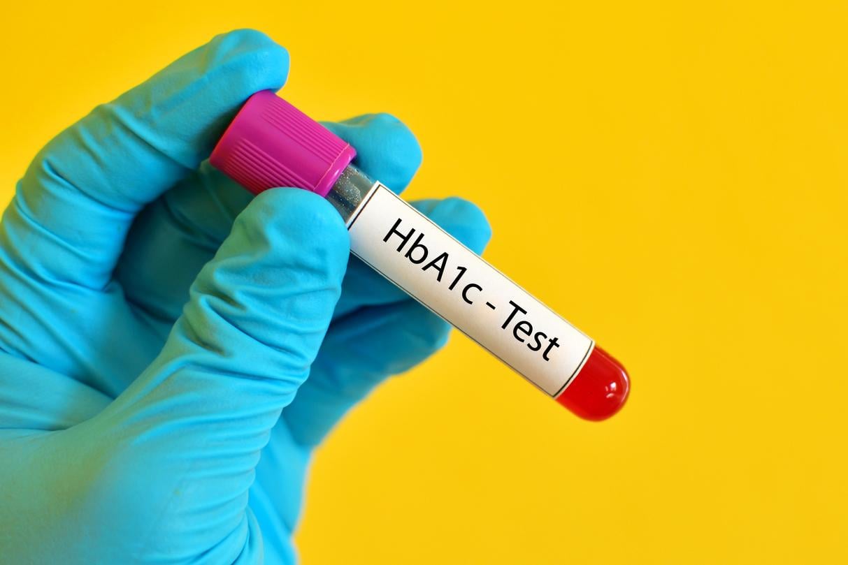 γλυκοζυλιωμένη αιμοσφαιρίνη